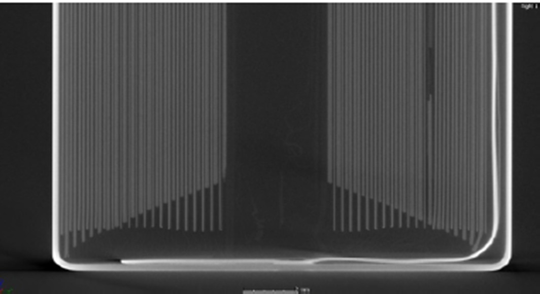 圆柱电池CT实例-俯视图切片下端正极材料缺失